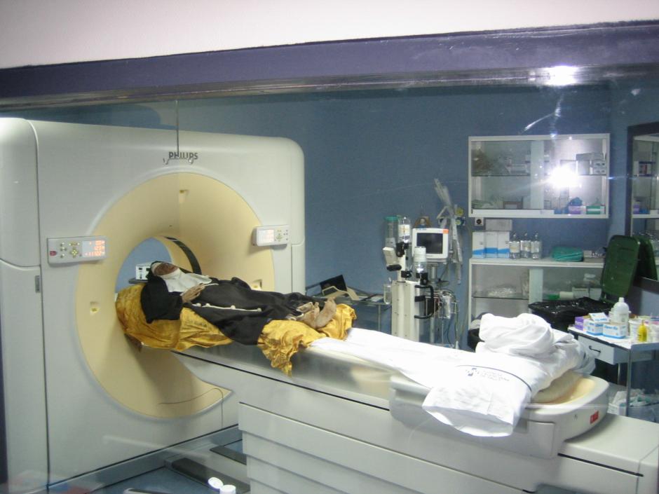 TAC al cuerpo de Sor Úrsula en el Hospital General de Alicante