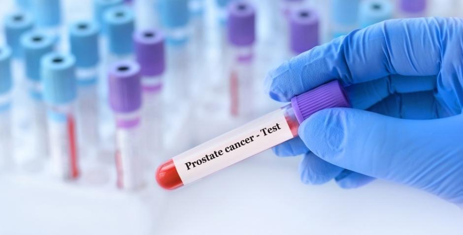 Una uróloga advierte de que el dolor óseo en hombres mayores es una "señal silenciosa" de cáncer de próstata metastásico
REMITIDA / HANDOUT por RUBER INTERNACIONAL
Fotografía remitida a medios de comunicación exclusivamente para ilustrar la noticia a la que hace referencia la imagen, y citando la procedencia de la imagen en la firma
11/6/2025