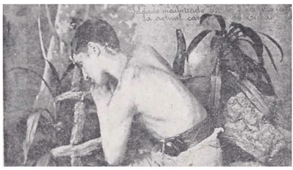El joven Jerónimo Blanco mostrando los machetazos en el cráneo, cuello y espalda.