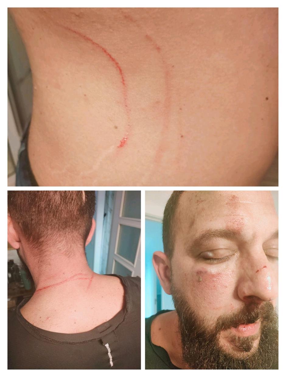 Imágenes del guardia civil agredido, con una lesión ocular y fractura de mandíbula