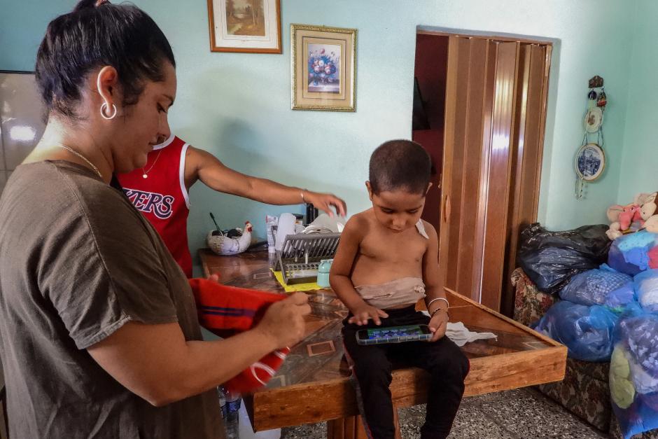 Jessica Rodriguez Romero dresses her son, Luis Angelo, after completing a feeding session necessitated by his tracheostomy, at their home in the Santa Fe neighbourhood of Havana, on July 2, 2025. Cuban pharmacies and hospitals lack even the most basic medicines because the country cannot afford the $300 million needed to import the raw materials required to produce the 650 drugs on its essential medicines list. (Photo by ADALBERTO ROQUE / AFP)