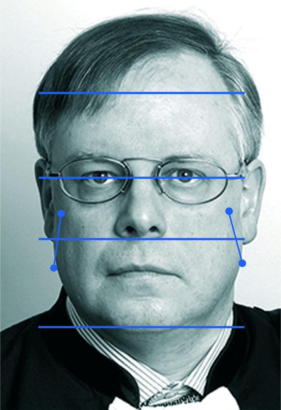 Esquema realizado por el doctor Gabarre