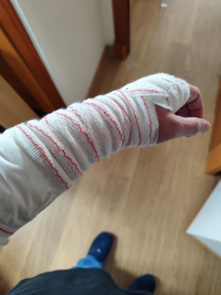 Nuestro protagonista también sufrió lesiones en la muñeca de su brazo izquierdo