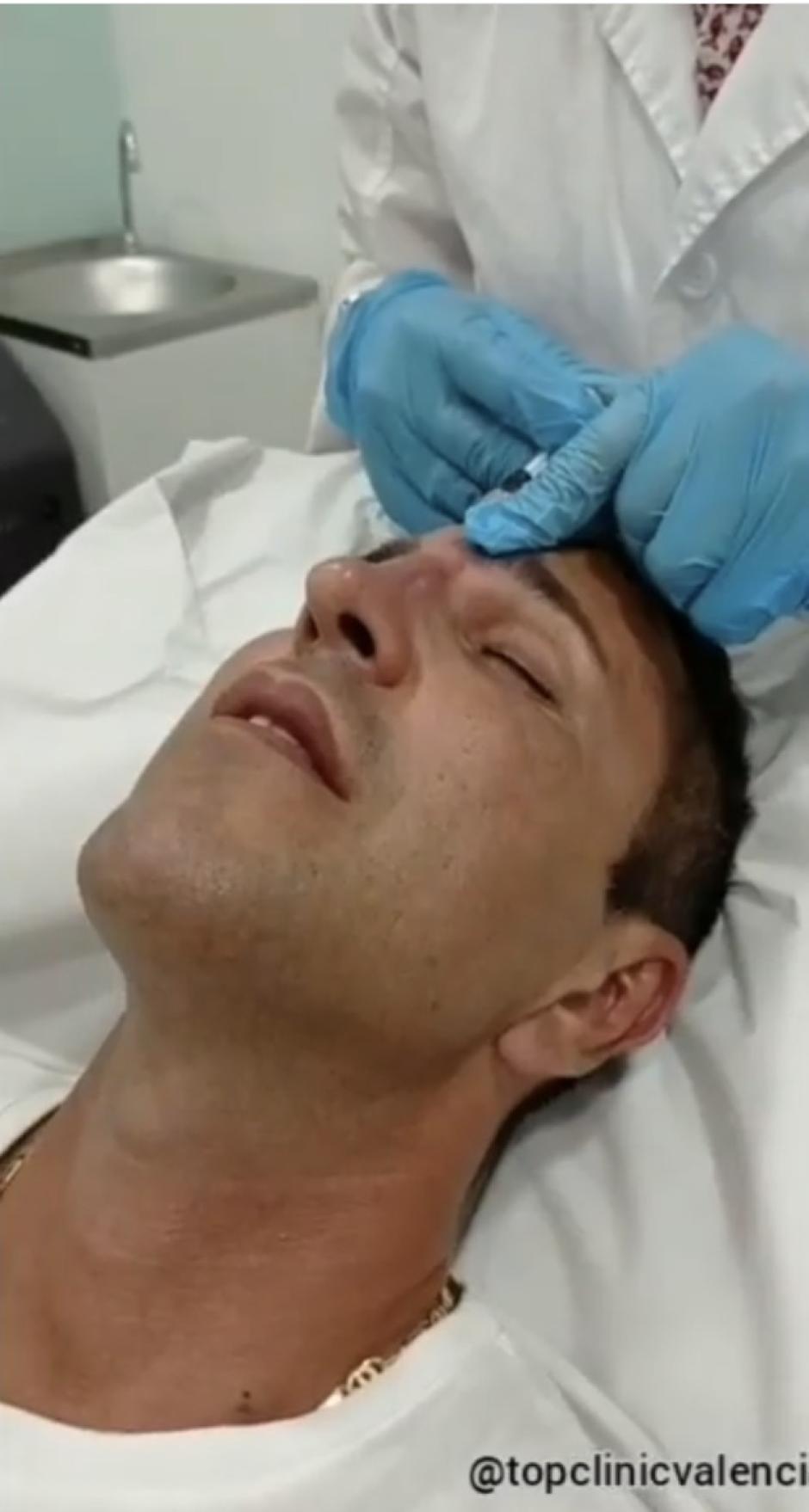 Imagen de Mauri Anglés realizándose una rinomodelación en su clínica estética, Top Clinic