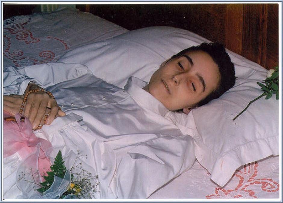 Beata Chiara "Luce" Badano (1971–1990), una joven laica italiana perteneciente al Movimento de los Focolares, fotografiada en su lecho de descanso tras su fallecimiento a causa de un osteosarcoma
